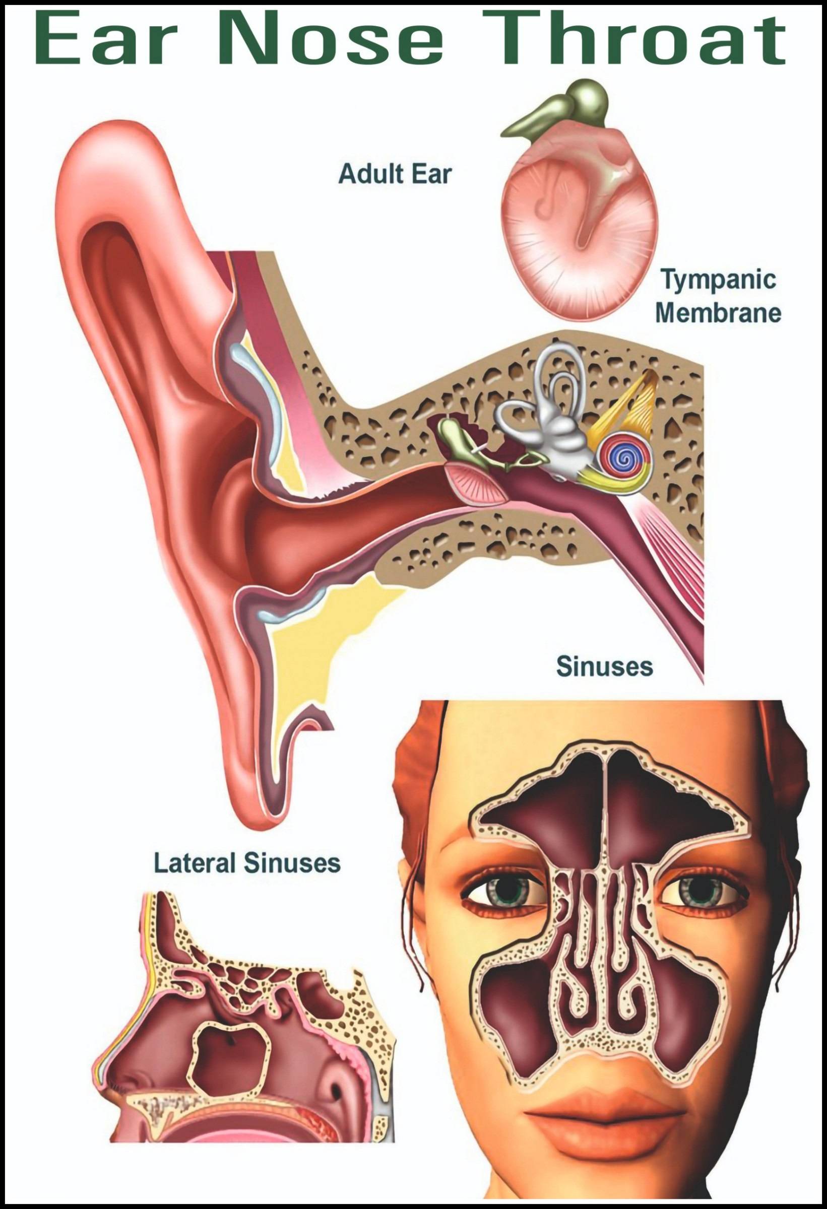Ear Infections Poster