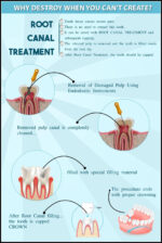 Root Canal Treatment Poster